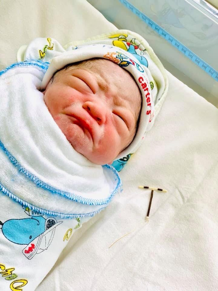 Sau khi em bé được các bác sỹ, nữ hộ sinh đón thì chiếc vòng tránh thai của sản phụ cũng theo ra. Các nữ hộ sinh trong ca trực đã lấy vòng tránh thai của mẹ để vào tay em bé và chụp ảnh đăng lên mạng.