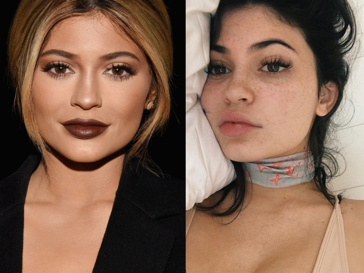 Kylie Jenner không ngại để lộ khuôn mặt tàn nhang của mình với người hâm mộ trên Instagram. Ảnh: Getty