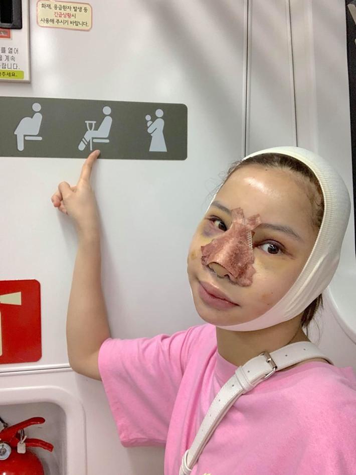 Dù mới phẫu thuật nhưng Lưu Đê Ly vẫn ra đường và di chuyển trên các phương tiện công cộng.