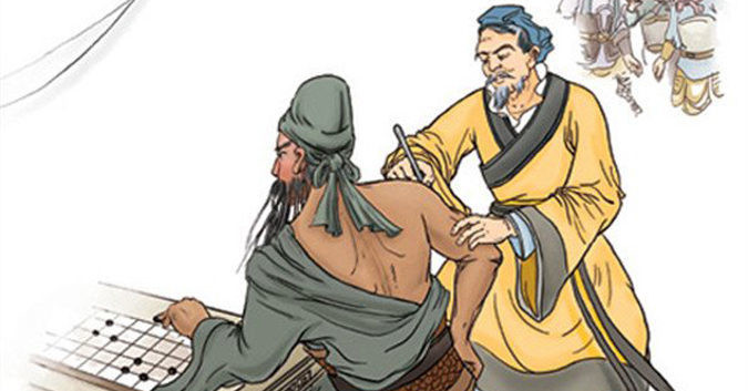 Khi đánh Phán Thành, Quan Vũ bị trúng độc ở cánh tay. Do độc tố quá mạnh, Hoa Đà phải mổ vào tới xương Quan Vũ. Tuy nhiên, phần xương của hổ tướng thời Tam Quốc này đã chuyển xanh, cần cạo bỏ mà khi ấy không hề có thuốc giảm đau hay thuốc tê.