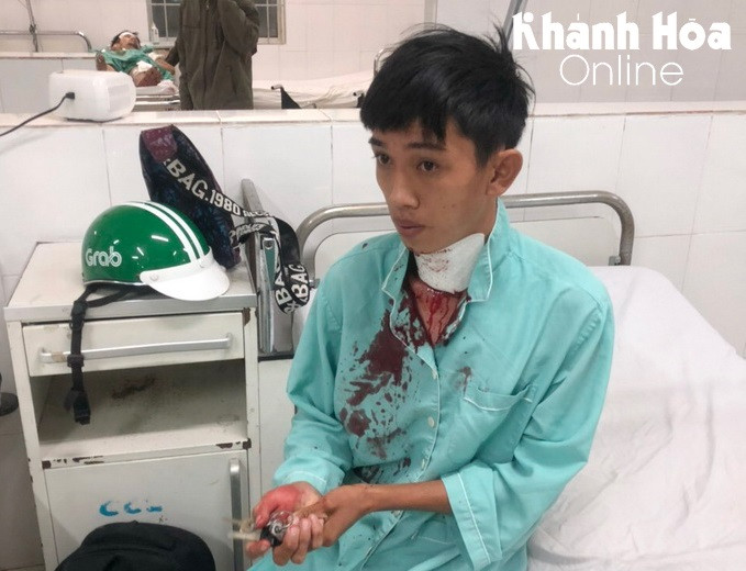Tài xế xe ôm công nghệ thoát chết khi bị khách cứa cổ trong đêm. Tối ngày 4/12, anh Phan Hoàng Giang (SN 1996, thường trú quận Ô Môn, TP. Cần Thơ) – lái xe ôm công nghệ (Grabbike) ở Nha Trang chở một nam thanh niên về khu vực Cầu Ké, xã Vĩnh Hiệp với giá hơn 40 nghìn đồng. Khi đến khu vực qua cầu Ké, đối tượng yêu cầu dừng xe và bất ngờ dùng vật sắc cửa cổ anh Giang. May mắn thời điểm đó có người dân chạy đến nên lái xe ôm đã thoát chết. Ảnh: Báo Khánh Hòa.