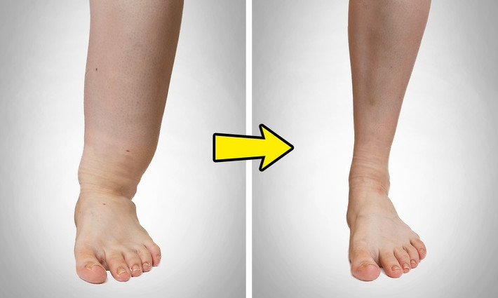 Massage chân còn làm giảm các ảnh hưởng của chứng phù nề ở phụ nữ mang thai. Bạn có thể xoa bóp chân khoảng 10-20 phút mỗi ngày.