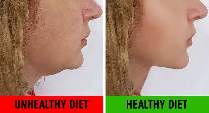Ăn uống lành mạnh: Thực đơn lành mạnh, đủ dinh dưỡng sẽ giúp hạn chế nọng cằm. Thay thế carbs tinh chế bằng ngũ cốc nguyên hạt, ăn nhiều rau quả tươi, đặc biệt là những loại quả nhiều nước như dưa chuột, dưa hấu hay các loại rau củ giúp tăng collagen như cà chua, ớt chuông, tỏi, bí ngô... để giúp da khỏe mạnh, săn chắc hơn.