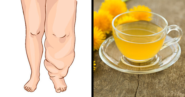 Bồ công anh từ xưa đã được sử dụng như thuốc lợi tiểu tự nhiên. Ở châu Âu, chiết xuất bồ công anh được sử dụng để điều trị nhiều bệnh trạng và được Ủy ban E của Đức chấp thuận để giảm giữ nước. Ảnh: BS.