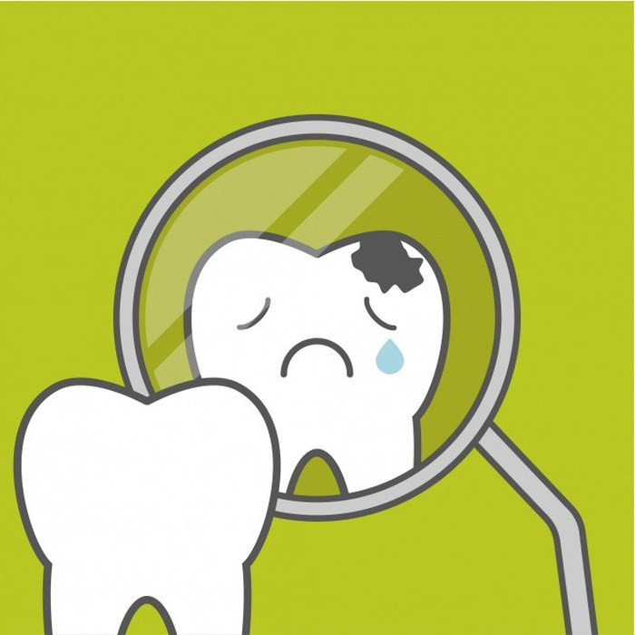 Dễ sâu răng hơn: Mặc dù hàm răng của chúng ta không tiếp xúc trực tiếp với ánh nắng nhưng nhiều nghiên cứu đã chỉ ra rằng, những người bị thiếu ánh sáng thường gặp phải nhiều vấn đề về nha chu hơn bình thường. Trong đó, tình trạng phổ biến nhất là sự xuất hiện của các lỗ thủng trên răng.