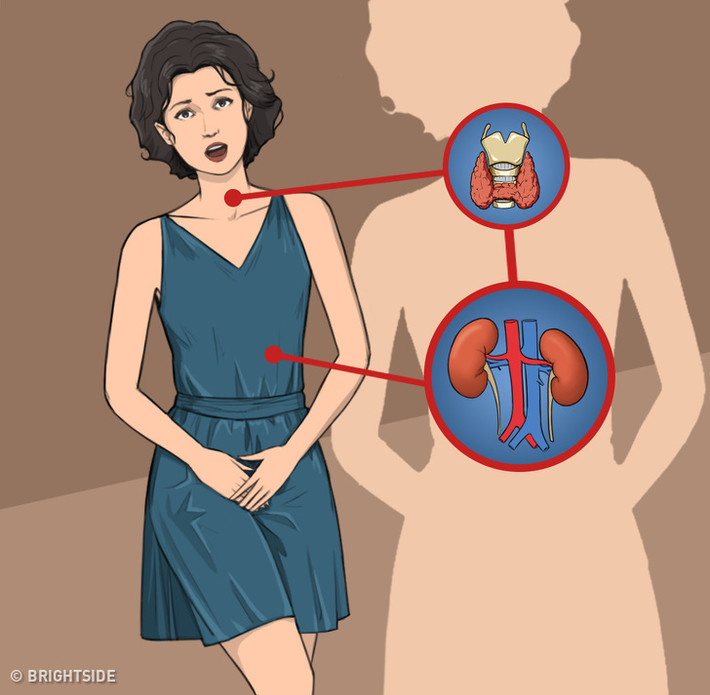 Đi tiểu nhiều: Chuyển hóa nhanh hơn khiến tăng lưu lượng máu. Điều này làm cho thận của bạn lọc nhiều hơn khiến bạn đi tiểu nhiều hơn.