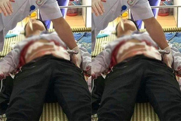 Nam sinh lớp 9 ở Yên Bái đâm bạn học bị thương. Trưa ngày 20/3, tại cổng trường THCS Hưng Khánh (Trấn Yên, Yên Bái), nam sinh N.M.Đ. (SN 2006, học sinh lớp 9C trường THCS Hưng Khánh) đã dùng dao đâm học sinh N.M.P. Nguyên nhân do mâu thuẫn khi chờ xe đưa đón sau khi tan học.