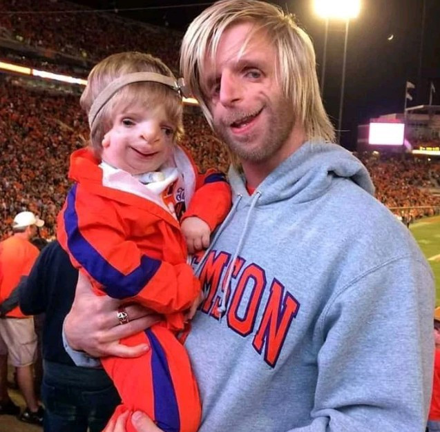 Trái ngược với quá khứ đầy tự ti và đau đớn, Jono Lancaster giờ đây đã trở thành một diễn giả truyền cảm hứng, sẵn sàng lên tiếng ủng hộ những người đồng cảnh ngộ.