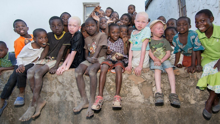 Trong số này đáng sợ và hãi hùng nhất là chuyện xảy ra ở Tanzania. Các pháp sư, thầy phù thủy lợi dụng sự thiếu hiểu biết và mê tín của người dân để thúc đẩy niềm tin mù quáng.