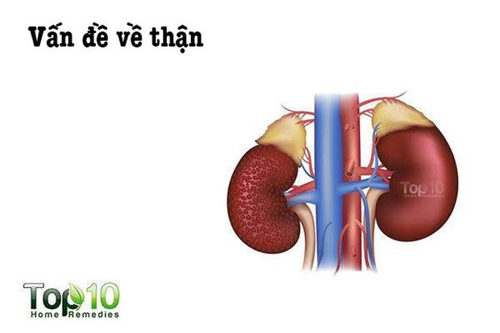Vấn đề về thận: Nhiều nghiên cứu cho thấy lạm dụng thuốc giảm đau sẽ gây ra các vấn đề về thận. Với việc sử dụng thuốc giảm đau như ibuprofen hoặc naproxen liên tục, một số người thậm chí có thể bị suy thận. Tuy nhiên, điều này xảy ra nhiều hơn ở những người bị tiểu đường hoặc cao huyết áp.