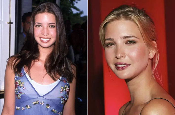 Bức ảnh chụp lúc Ivanka 15 tuổi (trái) được so sánh với năm 2004 để thấy rõ sự thay đổi trên khuôn mặt cô, đặc biệt là cái mũi đã có sự khác biệt.