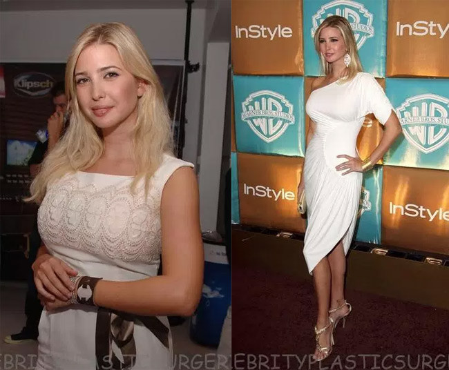Ivanka Trump gây sốc với vòng 1 bốc lửa khi xuất hiện trong những sự kiện năm 2007. Tuy nhiên ai cũng khen cô đẹp hơn khi phẫu thuật thẩm mỹ mũi, ngực.