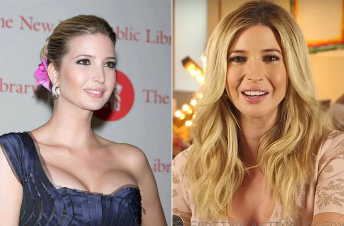 Sở hữu khuôn mặt bầu bĩnh giống cha, nhưng càng lớn nét mặt của Ivanka càng gọn gàng và xinh xắn hơn, đây được cho là nhờ công lớn của chất làm đầy khi cô tiêm vào má để định hình lại khuôn mặt.