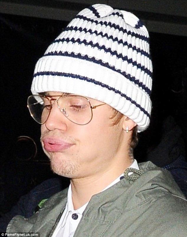 Cận cảnh khuôn mặt xấu xí thảm hại của Justin Bieber khi anh rời hộp đêm lúc 4h sáng. (Ảnh: FameFlynet)