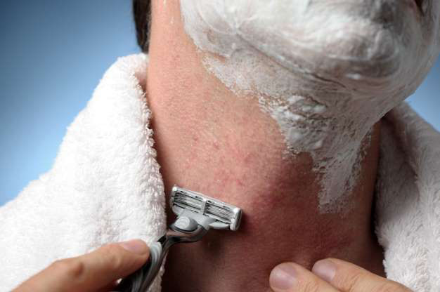 Vết sưng không tan - Một số người nghĩ đó là mụn hay vế sưng do dao cạo. Một số người khác lại nhận thấy đó là những vết xước hay sẹo mà họ không nhớ là đã gặp phải từ khi nào. Những vết sưng có phần bí ẩn này có thể là ung thư biểu mô tế bào, một dạng ung thư da có thể gặp phải ở cả nam giới và phụ nữ, nhưng chúng có thể điều trị được. Nó có thể xuất hiện ở da đầu, mí mắt, vành tai hay ở lưng… Dù không có xu hướng gây di căn nhanh như các khối u ác tính, nhưng nếu càng để lâu, các vết sẹo sẽ càng trở nên xấu xí.