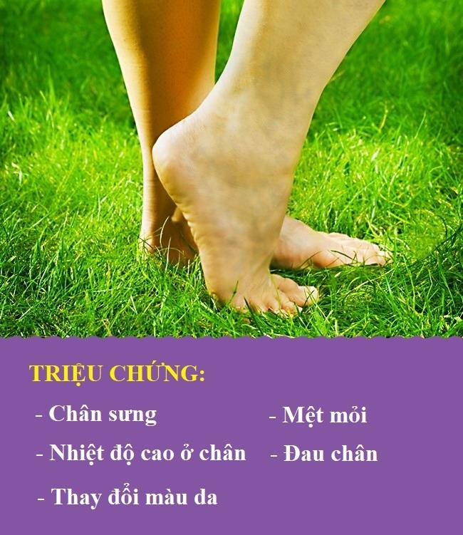 Huyết khối: Sưng, đau một hoặc cả hai chân, kèm theo mệt mỏi, nhiệt độ tăng ở chân, da đổi màu, có thể báo hiệu chứng bệnh huyết khối tĩnh mạch sâu. Vấn đề này rất nguy hiểm. Nếu bạn nhận thấy những dấu hiệu trên, hãy đi khám bác sĩ ngay lập tức.