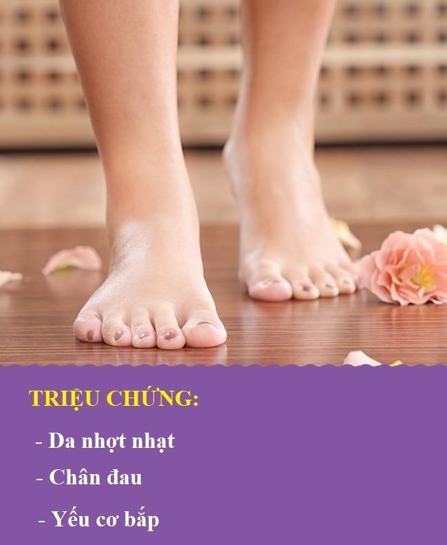 Xơ vữa động mạch: Khi bạn bị xơ vữa động mạch, bàn chân nhận quá ít máu, khiến chúng tái nhợt và đau đớn. Trong phần lớn trường hợp, mọi người bỏ qua các triệu chứng của căn bệnh này. Tuy nhiên, nó có thể gây hậu quả nghiêm trọng tới tim, não bộ và nhiều cơ quan quan trọng khác.
