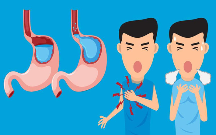 Giảm trào ngược axit: Mặc dù nước chanh có tính axit, nhưng một lượng nhỏ nước cốt chanh pha với nước có tác dụng trung hòa axit trong dạ dày giúp ngăn ngừa trào ngược axit trong dạ dày.
