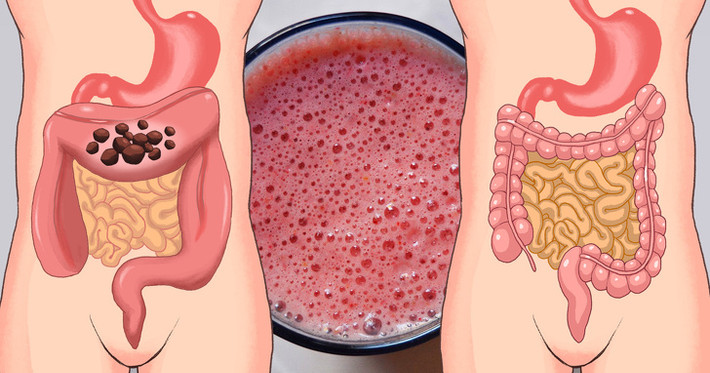 Bổ sung probiotics: Nghiên cứu của các nhà khoa học cho thấy bổ sung probiotics (vi khuẩn tốt) có thể giúp ngăn ngừa và hỗ trợ điều trị ung thư đại tràng. Những vi khuẩn tốt này có tác dụng ngăn chặn quá trình viêm và cải thiện nhu động ruột. Các thực phẩm giàu probiotics bạn có thể bổ sung vào chế độ ăn uống hàng ngày là: Sữa chua Hy Lạp, giấm táo, kimchi, miso, kombucha và một số loại phô mai.