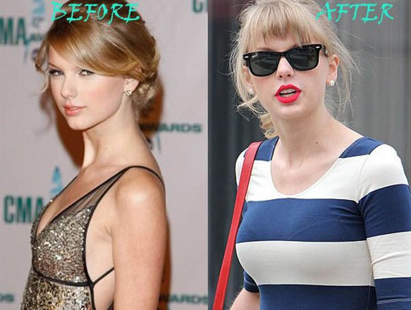 Từ năm 2012, Taylor Swift đã bị săm soi chuyện bơm ngực khi so sánh hình ảnh cô năm 2010 và hai năm sau đó.