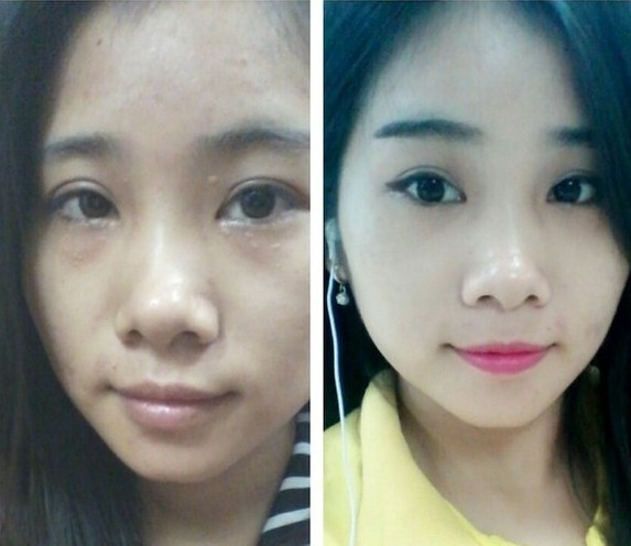 Bằng các phần mềm chỉnh sửa ảnh trên di động, qua vài thao tác đơn giản, làn da mụn, sần sùi sẽ trở nên mịn màng.