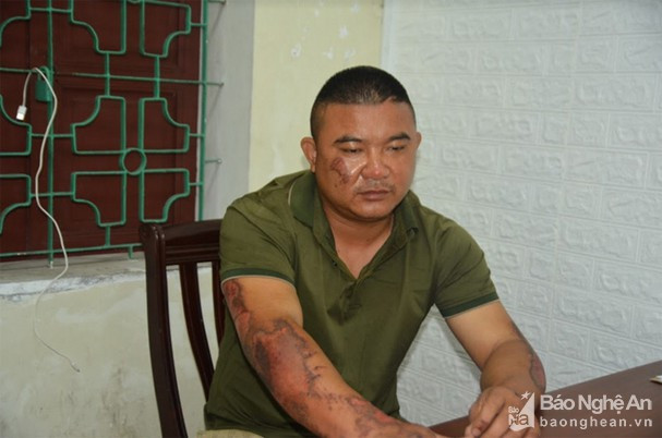 Đổ xăng đốt nhà người tình cũ: Bùi Sĩ Công (SN 1983), trú xã Nghi Phú (TP. Vinh, tỉnh Nghệ An) và chị Nguyễn Thị T. từng có quan hệ tình cảm. Do không thể giải quyết mâu thuẫn, 12h trưa 30/7/2019, Công mang theo can xăng 10 lít đến nhà chị T. yêu cầu chị này ra ngoài để nói chuyện nhưng không được đáp ứng. Bực tức, Công đổ xăng trước cửa phòng ngủ ở tầng 1 rồi châm lửa, sau đó bỏ chạy. Vụ cháy khiến 5 người trong phòng bị thương.