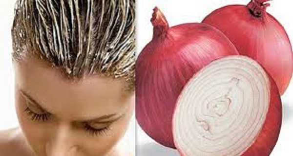2. Hành củ: Dùng hành củ khô, bóc vỏ, giã lấy nước và cho lên tóc cho ngấm đều vào da đầu và tóc. Ủ tóc, sau vài giờ thì gội sạch. Đây là một trong những cách trị gàu mang lại hiệu quả rất cao. Ảnh: Dailyhealthtips.
