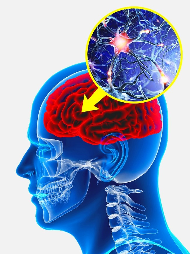 9: Tiêu thụ nhiều rượu phá hủy tế bào não: Nghiên cứu cho thấy không có sự khác biệt giữa mật độ nơ-ron trong số những người uống nhiều rượu và những người không uống. Tuy nhiên, rượu phá hủy các đường dẫn thần kinh, có thể can thiệp vào việc phát triển các tế bào não mới. May thay, sự thay đổi này có thể đảo ngược và các đường thần kinh được khôi phục sau khi bạn ngừng uống rượu. Ảnh: Depositphotos.