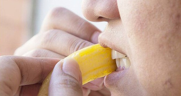 7. Vỏ chuối: Cùng với vỏ cam thì vỏ chuối cũng có tác dụng tương tự. Sử dụng phần trong của vỏ chuối chà xát lên hàm trăng 4 – 5 phút, sau đó thực hiện bước đánh răng như thường lệ. Thực hiện 4 lần trong tuần, bạn sẽ nhận thấy sự mờ dần các vết ố vàng trên thân răng. Ảnh: WP.