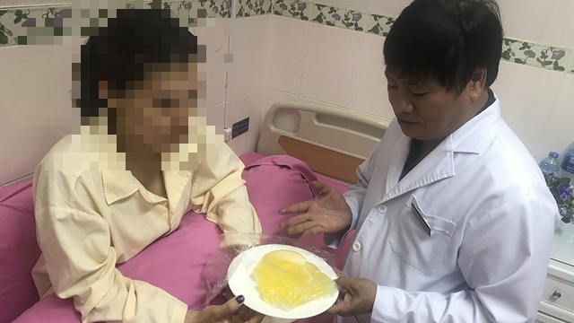 Bác sĩ Hoàng Văn Hồng chia sẻ, bệnh nhân cấp cứu trên máy bay của hãng hàng không Quốc gia Việt Nam (Vietnam Airline) là do chảy máu từ vết mổ do mới phẫu thuật và túi ngực của bệnh nhân còn nguyên vẹn không bị vỡ.