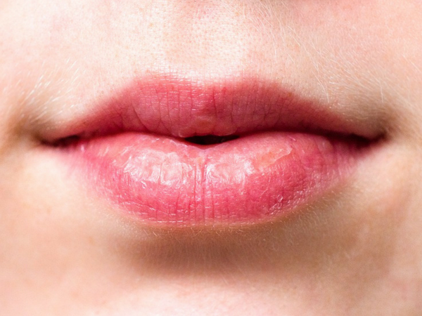 Để có một làn da mịn màng và không bị khô thì bạn cần bổ sung nhiều vitamin C. Ảnh: Boldsky.