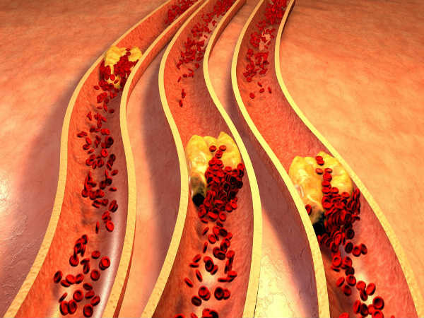 Nấm trắng chứa nhiều protein và giúp kiểm soát mức cholesterol. Nấm có chứa chất xơ và một số enzim giúp giảm mức cholesterol. Thành phần protein hỗ trợ đốt cháy cholesterol và chất béo dư thừa trong cơ thể. Ảnh: Boldsky.