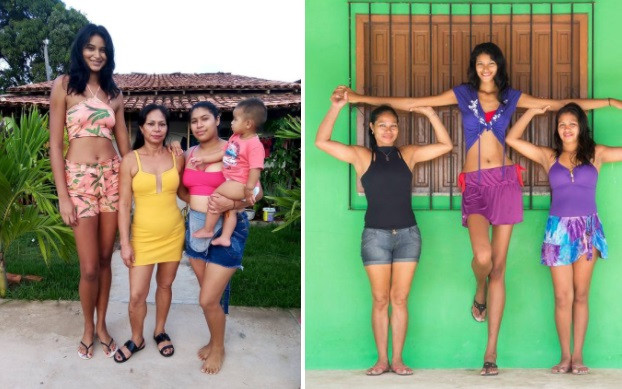 Thân hình quá cao khiến các khớp của cô, đặc biệt là ở hai chân, đau đớn mỗi khi di chuyển nhiều. Năm 15 tuổi, Silva được phẫu thuật cắt bỏ khối u và chiều cao chững lại từ đó. Dù vậy, cô gái sinh năm 1995 vẫn gặp nhiều bất tiện trong sinh hoạt, thậm chí không thể đi xe buýt tới trường. Vì vậy, Silva sớm nghỉ học.