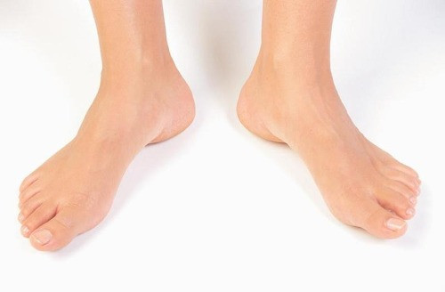 Các mô mỡ xung quanh gân và bắp chân sẽ được phẫu thuật hút mỡ việc phẫu thuật này khá đơn giản và không ảnh hưởng quá nhiều tới chân như phẫu thuật kéo dài chân hay gọt chân.