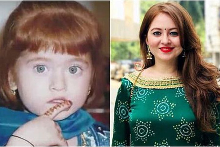 Pooja Ganatra (27 tuổi) sinh ra ở Mumbai, Ấn Độ, từng là chủ đề bàn tán của những người hàng xóm bởi ngoại hình khác biệt của cô.