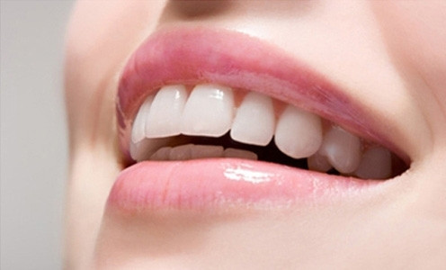 Một số trường hợp khác sau khi tẩy trắng răng thì men răng cũng có hiện tượng mất khoáng nhẹ. Có người răng bị đổi màu nghiêm trọng nhiễm sắc quá nặng.