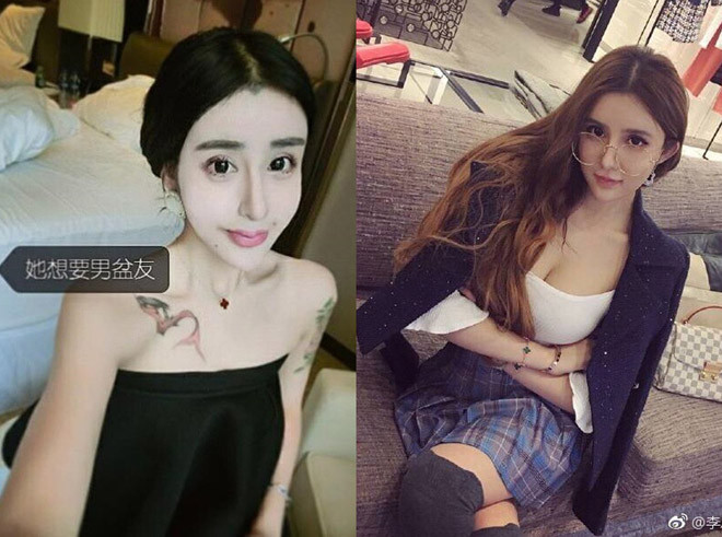 Nhiều người đã chỉ trích 9X vì cho rằng cô lạm dụng phẫu thuật thẩm mỹ để chạy theo trào lưu "mặt rắn" từng "gây sốt" một thời.