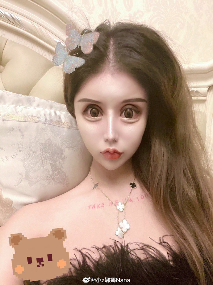 Ngay khi click vào trang Weibo của Nana, người đọc thấy bài ghim đầu trang kể tường tận về quá trình phẫu thuật thẩm mỹ. Cô gái này nói mình đã phẫu thuật thẩm mỹ 60 lần trong suốt 3 năm.
