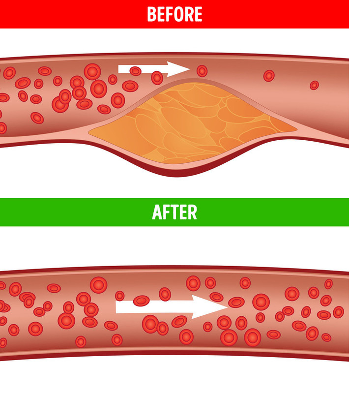Giảm cholesterol: Đu đủ rất giàu chất xơ, giúp làm giảm cholesterol. Nó cũng chứa các chất chống oxy hóa và vitamin có tác dụng tốt trong việc ngăn ngừa bệnh tim.