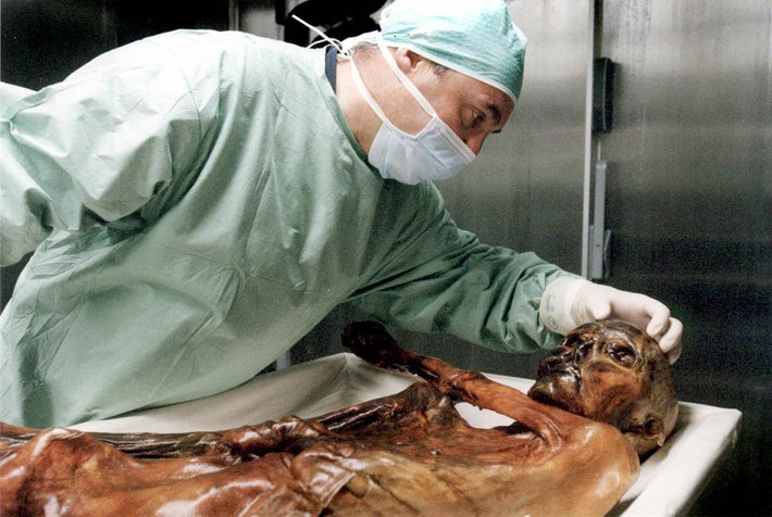 Với việc tìm thấy Otzi trong tình trạng nguyên vẹn, các chuyên gia gặp nhiều thuận lợi trong nghiên cứu, giải mã những bí ẩn về người đàn ông sống trong thời đồ Đồng này.
