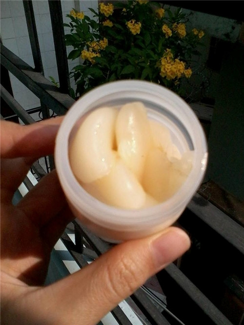Người bị bệnh trĩ, hoặc bị đau có thể lấy mỡ trăn trộn với giấm và đắp trực tiếp lên vùng bị tổn thương. Ảnh: Blogsuckhoe.