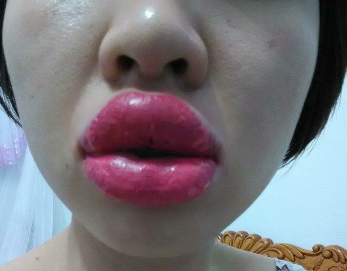 Xăm môi là hình thức xăm đổi màu môi giúp môi bạn luôn hồng hào mà không cần phải đánh son thường xuyên. Khi xăm môi bạn chỉ cần mất khoảng 1 tuần là và bờ môi trở lại bình thường... Ảnh: Tintuc.