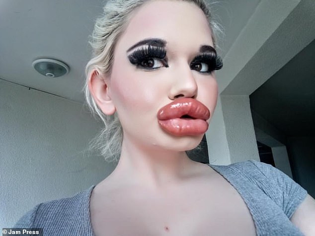 Andrea Emilova Ivanova, 22 tuổi, sinh sống ở thủ đô Sofia, Bulgaria, được mệnh danh là “búp bê Barbie đời thực” bắt đầu cuộc sửa đổi từ năm 2018. Cô đã chi hàng nghìn USD để tiêm chất làm đầy môi nhằm mục đích sở hữu đôi môi dày nhất thế giới.