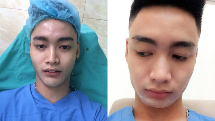 Hiện đang làm công việc của một chuyên viên make-up, stylist, nên Khả Hiếu tự nhận thấy ngoại hình và nhan sắc cũng là một lợi thế trong công việc. Để hiện thực hóa ước mơ muốn bản thân mình đẹp hơn, hot boy đồng tính Hà thành đã "chịu chi" hơn 200 triệu đồng để làm cằm, mũi, tiêm môi, tiêm gọn hàm, nhấn mí mắt, làm răng...
