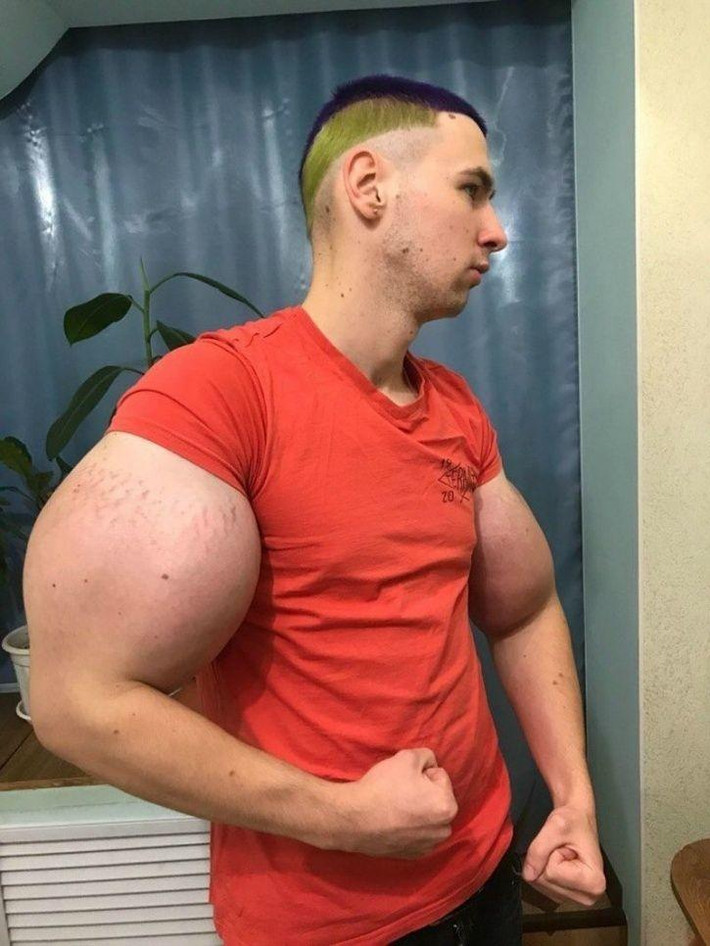 Kirill thường chia sẻ những hình ảnh khoe mẽ bắp tay to khác thường của mình trên mạng xã hội, thu hút sự chú ý của nhiều người.