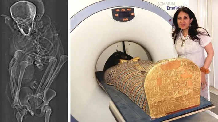 Xác ướp pharaoh Seqenenre Tao II được tìm thấy vào cuối thế kỷ 19. Những nghiên cứu ban đầu khiến giới chuyên gia tò mò bởi trên gương mặt của ông có nhiều vết thương.