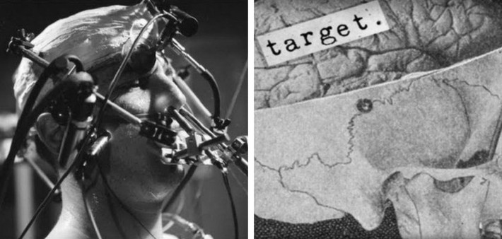 Các chuyên gia làm việc trong dự án MKUltra chủ yếu tập trung vào thuốc gây ảo giác LSD vì cho rằng nó có thể hỗ trợ việc thẩm vấn những người nghi là gián điệp của quốc gia khác.