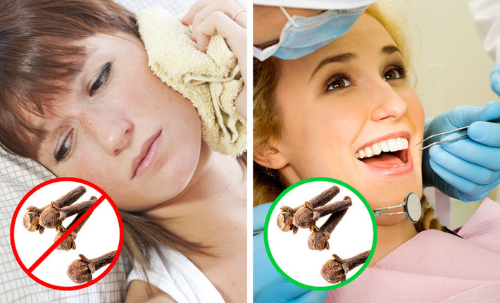 Hết đau răng: Thêm một công dụng nữa của loại gia vị này đó chính làm giảm đau răng. Nếu rơi vào trường hợp này, hãy ngậm một nhánh đinh hương vào vị trí răng đau, ngay lập tức các cơn đau buốt sẽ chấm dứt.