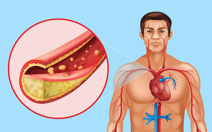 Kiểm soát mức cholesterol: Một nghiên cứu cho thấy tiêu thụ 3 muỗng bột hạt lanh mỗi ngày trong 3 tháng có thể làm giảm 20% cholesterol xấu và cholesterol toàn phần gần 17%. Theo các nhà khoa học, điều này là do lượng chất xơ cao trong hạt lanh.