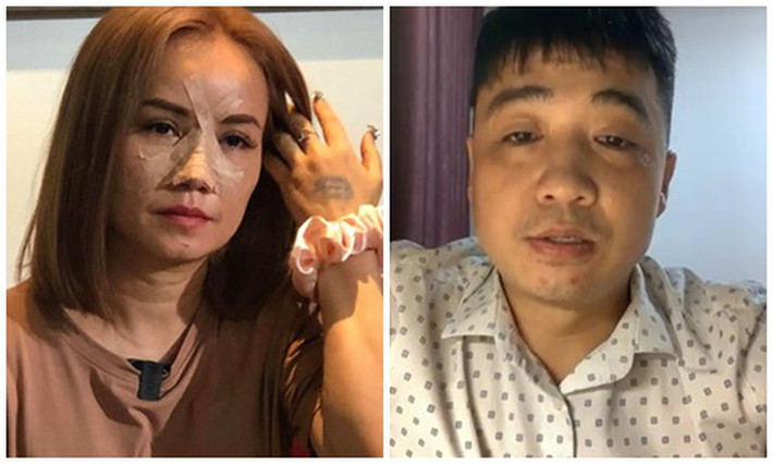 Chồng cũ livestream nói lý do đấm gãy mũi Hoàng Yến: Anh Cao Thắng gửi lời xin lỗi đến diễn viên Hoàng Yến vì đã đấm gãy mũi của cô và nhận lỗi. “Tôi biết mình sai rồi. Tôi sẵn sàng đối diện với pháp luật” - Cao Thắng nói và nêu lý do hành hung là có nhiều xích mích với nữ diễn viên "Về nhà đi con".